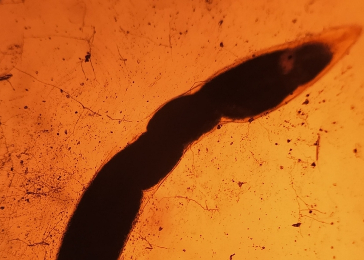 Brain-Invading Rat Lungworms Are Lurking in California