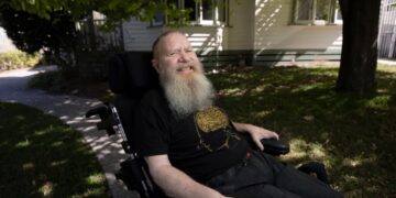 What It’s Like to Have a Brain Implant for 5 Years