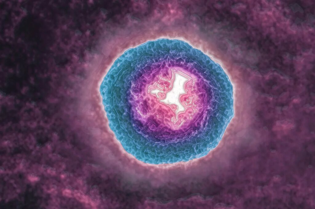 The Shingles Virus May Be Aging You More Quickly