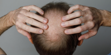 Scientists Are Growing Hair Follicles in a Lab, and It Might Fix Your Bald Head