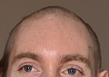 In This Corner of the Internet, Everyone Looks Better Bald