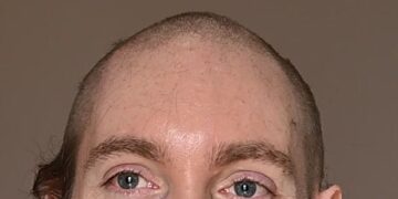 In This Corner of the Internet, Everyone Looks Better Bald