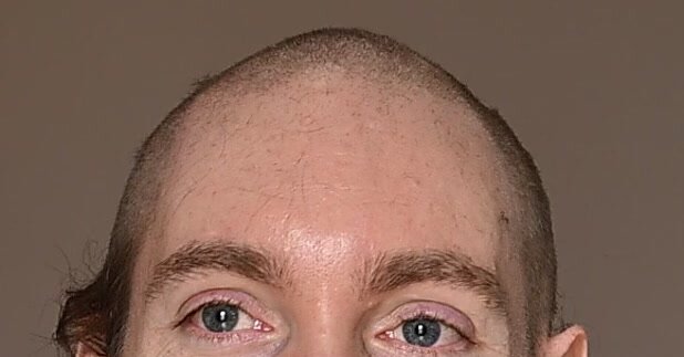 In This Corner of the Internet, Everyone Looks Better Bald