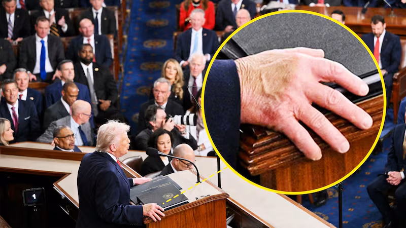The hand of President Donald Trump delivers the State of the Union address in the House Chamber of the US Capitol in Washington, DC, on Feb. 24, 2026.