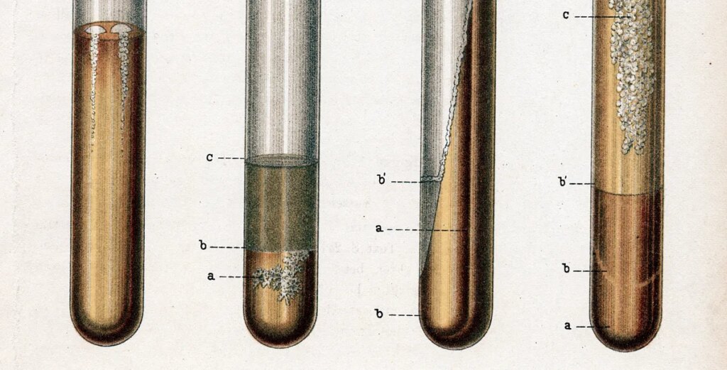 The world’s deadliest infectious disease is on the rise in the US
