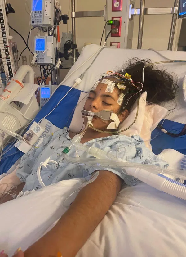 Khimberly Zavaleta, a 12-year-old girl, lies in a hospital bed with medical equipment attached to her face and head.