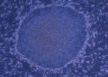 Japan Approves the World’s First Treatment Made With Reprogrammed Human Cells