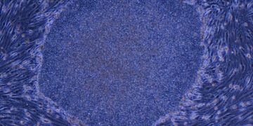 Japan Approves the World’s First Treatment Made With Reprogrammed Human Cells