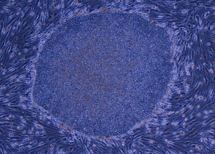 Japan Approves the World’s First Treatment Made With Reprogrammed Human Cells