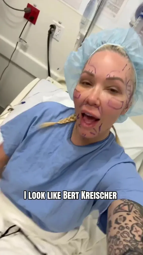 Bunnie Xo, Jelly Roll's wife, with markings on her face for a facelift.