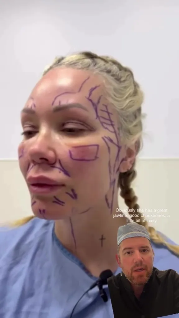 Woman with surgical markings on her face and a doctor in the corner.
