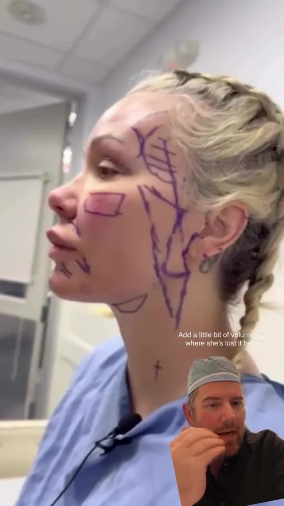 A woman with surgical markings on her face and neck, with a smaller image of a doctor in surgical scrubs in the bottom right corner.
