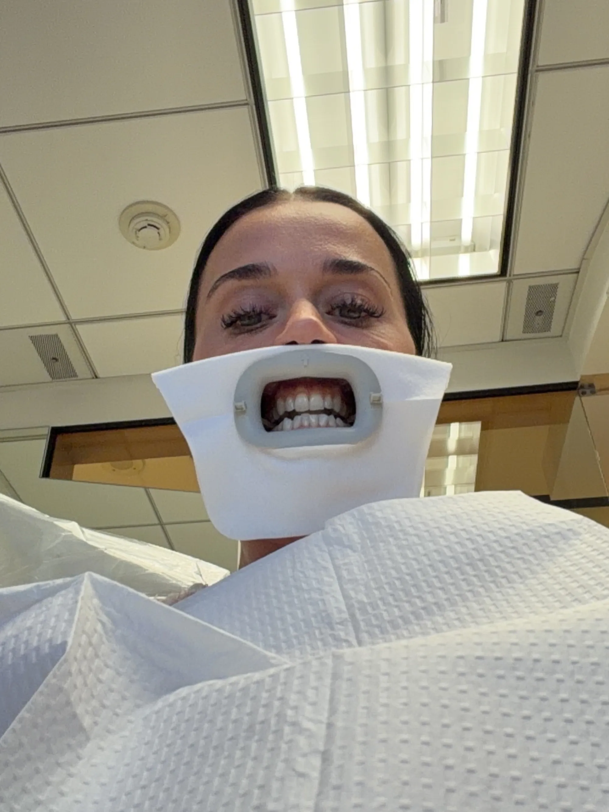 A woman in a dentist's chair with a mouth retractor.