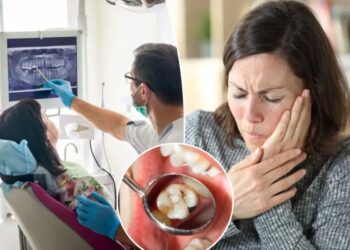 The surprising ways menopause can affect your mouth — and what you can do about it