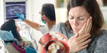 The surprising ways menopause can affect your mouth — and what you can do about it