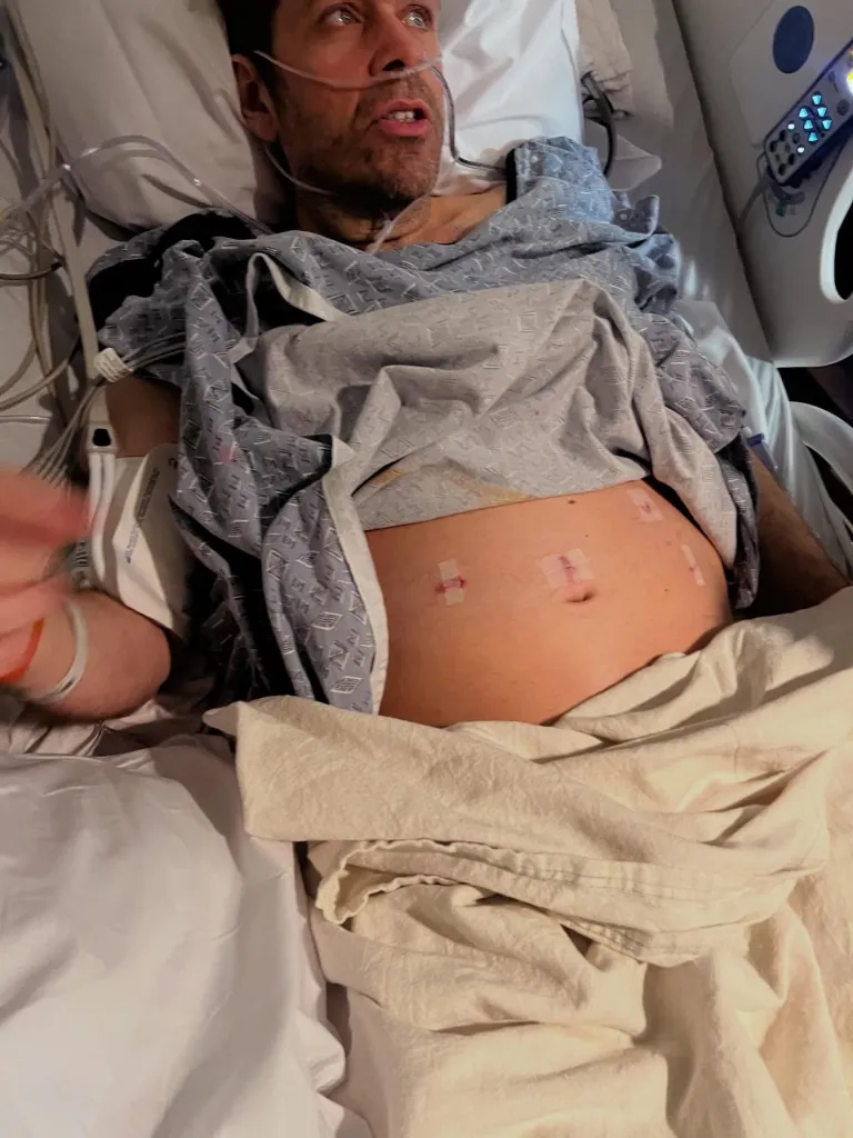 Perez Hilton in a hospital bed with a nasal cannula and bandages on his abdomen.