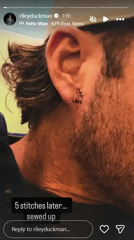 Green says he got five stitches after a fan threw a phone at him onstage