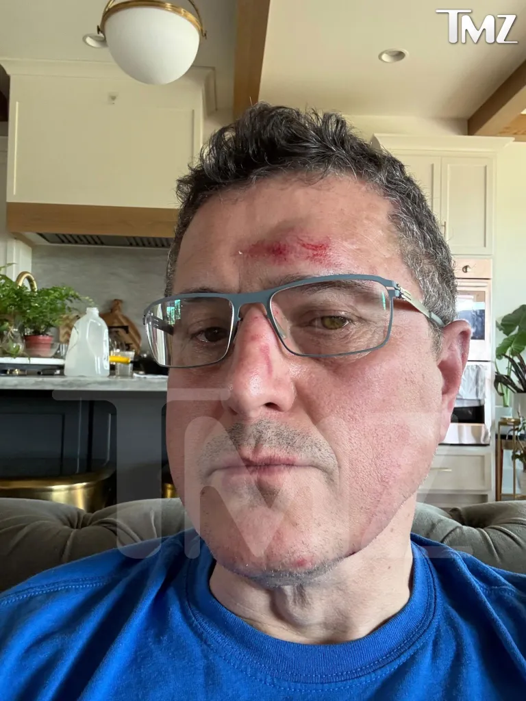 Ronnie Taylor, with visible injuries to his forehead and nose, allegedly from an attack by Alan Ritchson.