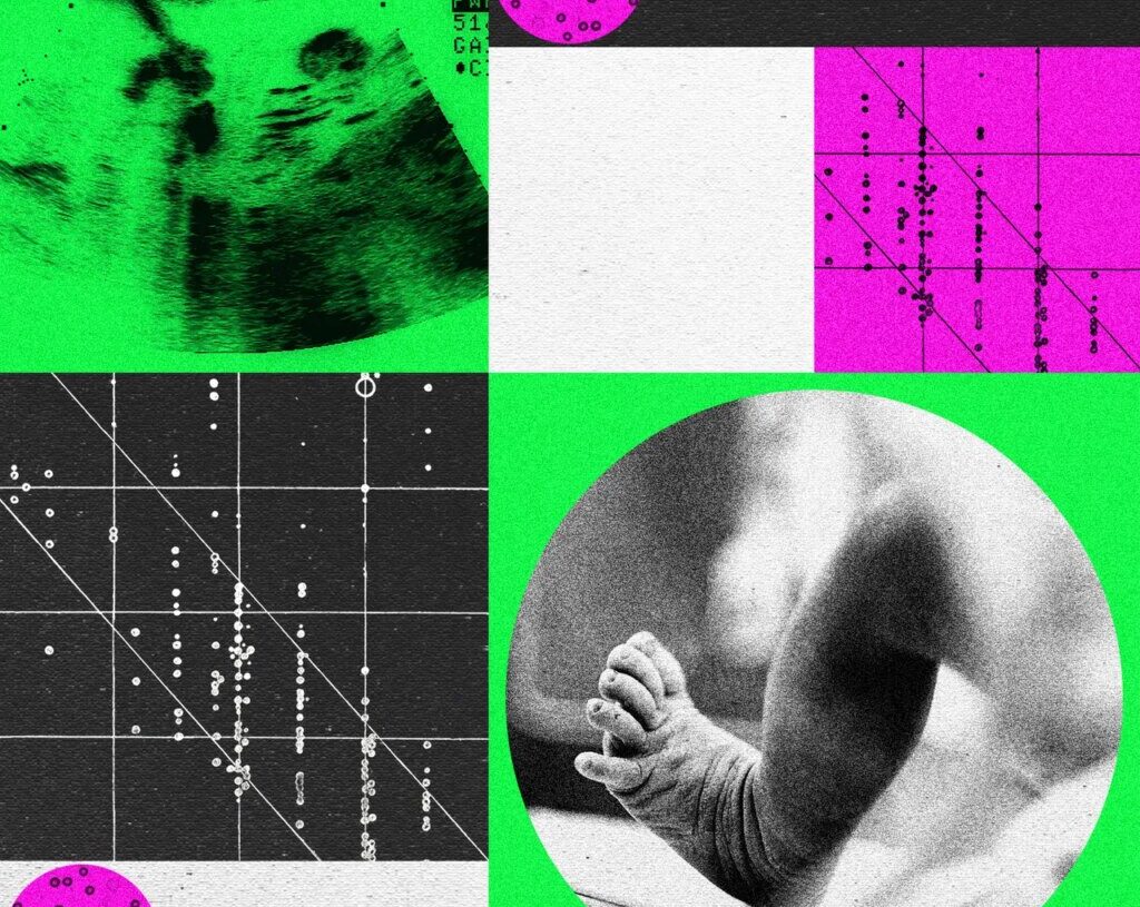 Designer Baby Companies Are in Turmoil