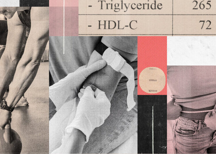 Confused About the New Cholesterol Guidelines? Here’s What to Know.