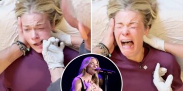 Experts weigh in on LeAnn Rimes’ emotional reaction to jaw release therapy: ‘Sympathetic response’