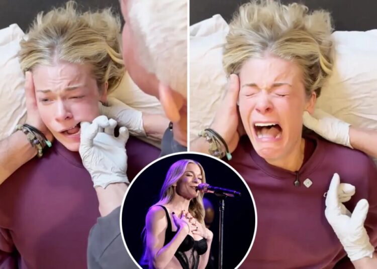 Experts weigh in on LeAnn Rimes’ emotional reaction to jaw release therapy: ‘Sympathetic response’