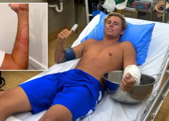 Australian surfer miraculously survives attack from ‘world’s most venomous animal’