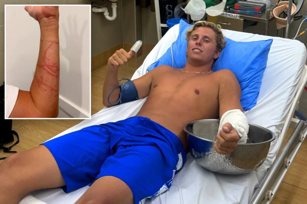Australian surfer miraculously survives attack from ‘world’s most venomous animal’