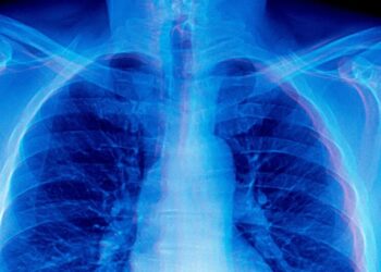 Frontier AI Models Are Doing Something Absolutely Bizarre When Asked to Diagnose Medical X-Rays