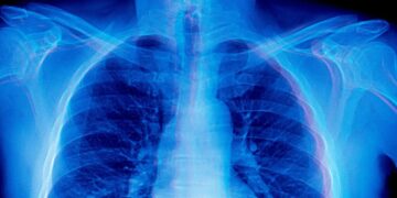 Frontier AI Models Are Doing Something Absolutely Bizarre When Asked to Diagnose Medical X-Rays