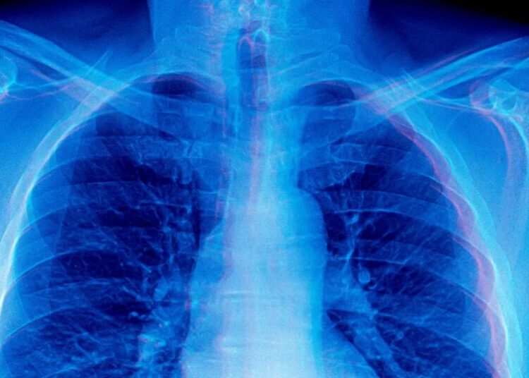 Frontier AI Models Are Doing Something Absolutely Bizarre When Asked to Diagnose Medical X-Rays