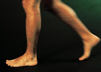 Naked Man Bursts Into Tesla Service Center With a Shotgun