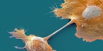 Two New Drugs Offer Hope for Pancreatic Cancer