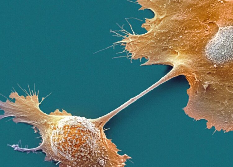 Two New Drugs Offer Hope for Pancreatic Cancer