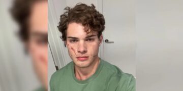 Clavicular Rushed to Hospital in Perfect Illustration of Why Looksmaxxing Is a Deadly Death Cult