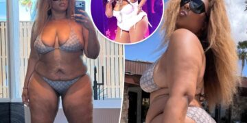 Lizzo shows off 60-pound weight loss with new bikini pics: ‘Whole stomach out all summer’