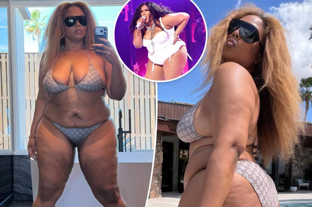 Lizzo shows off 60-pound weight loss with new bikini pics: ‘Whole stomach out all summer’