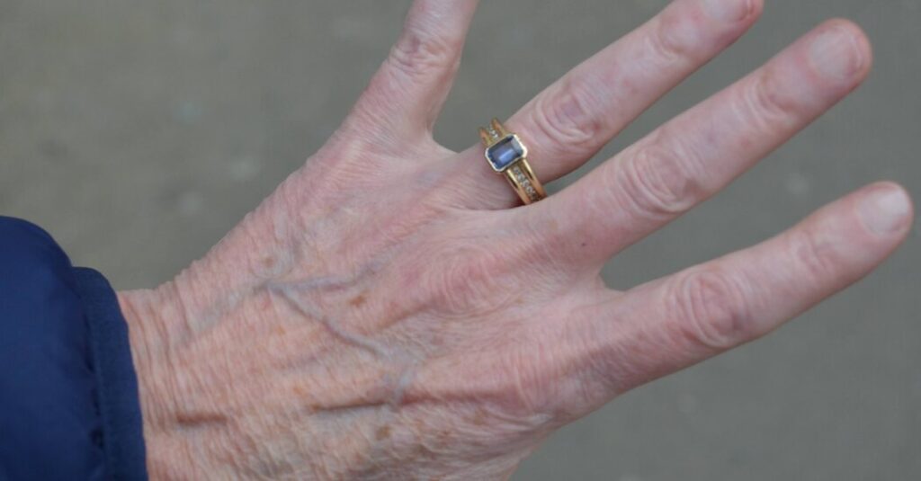 Lost and Found in the Garbage: An Heirloom Wedding Ring