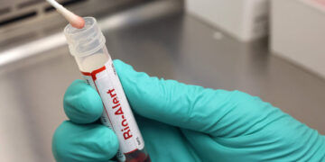 C.D.C. Pauses Testing for Rabies and Mpox