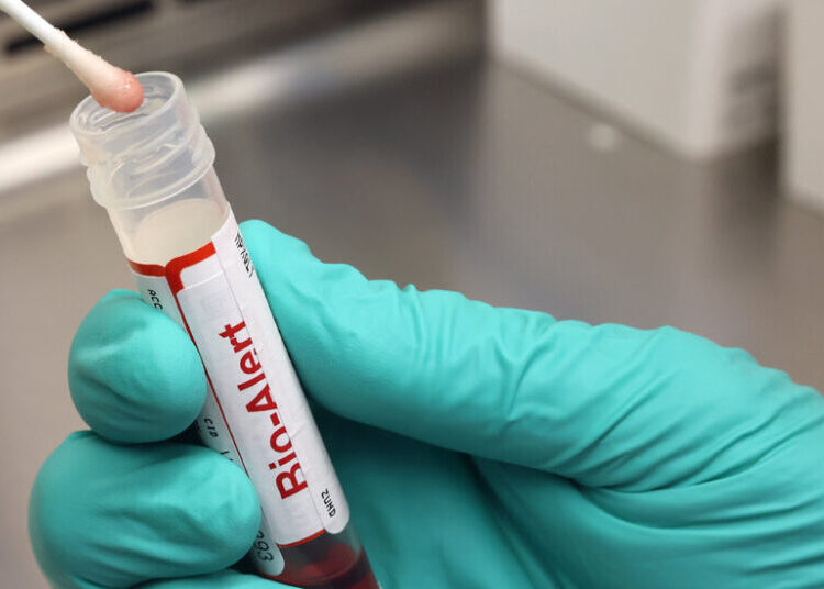 C.D.C. Pauses Testing for Rabies and Mpox