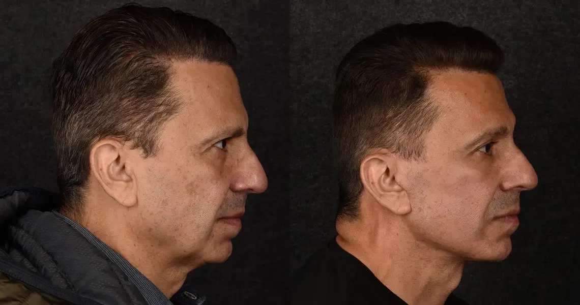 C-suite execs are paying surgeons big money to look fresh-faced, approachable, and less irritable