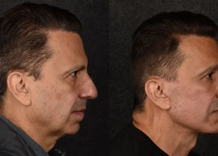 C-suite execs are paying surgeons big money to look fresh-faced, approachable, and less irritable