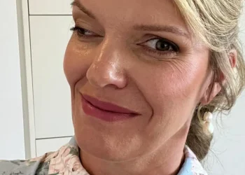 A facial injury changed my appearance — and my life. I’m strong and confident now, and I want others to feel the same.