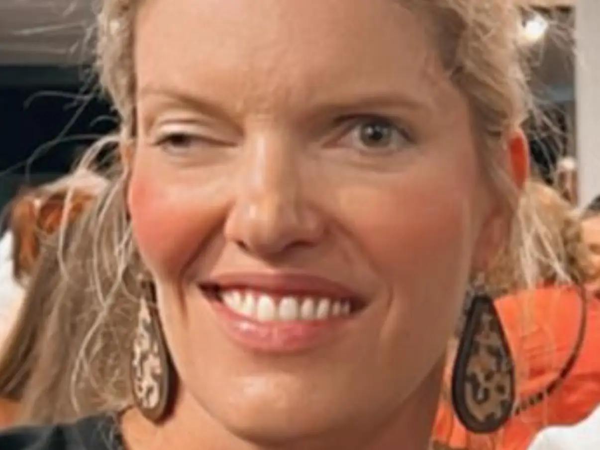 A woman with a facial difference