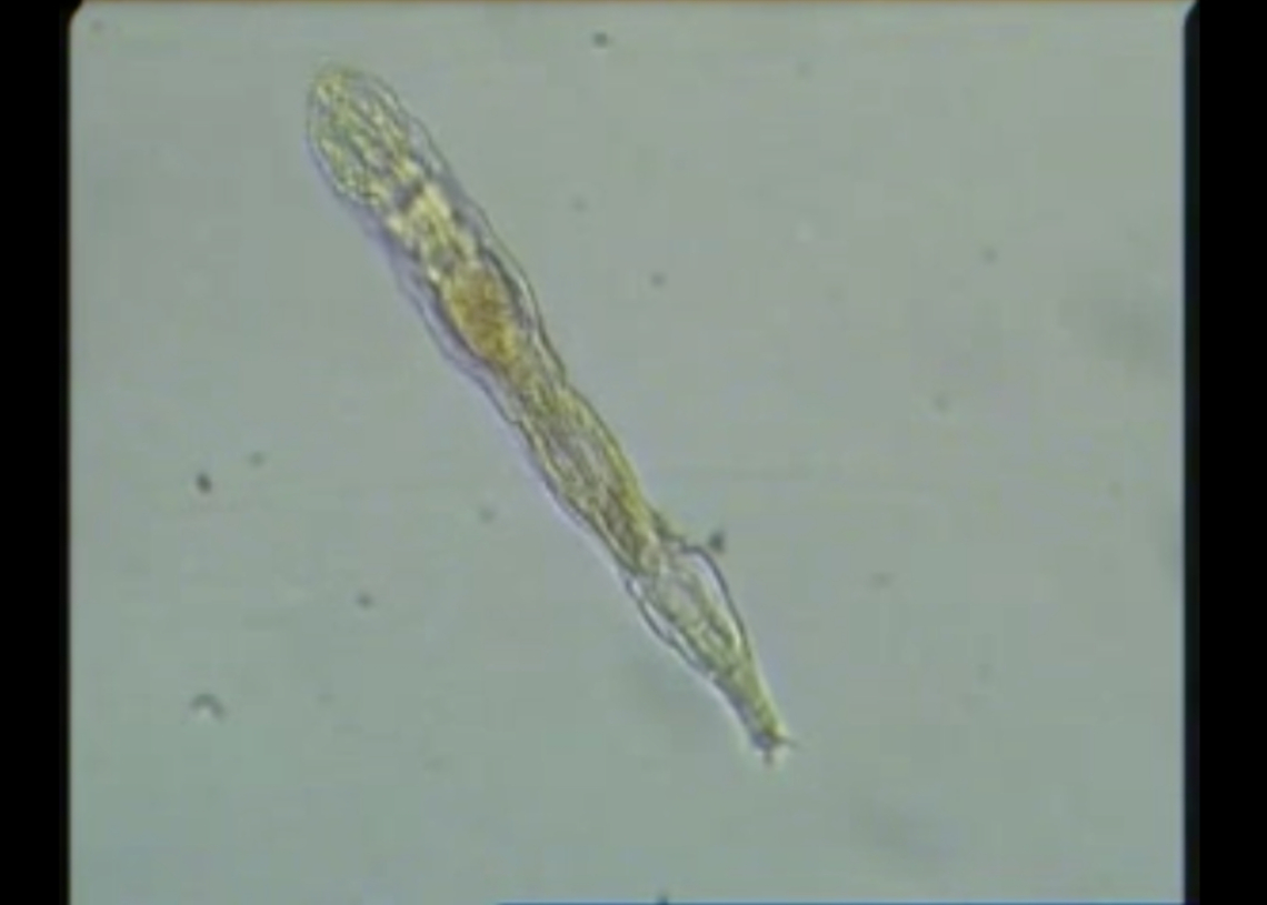 A ‘Zombie Worm’ Came Back to Life After 24,000 Years and Started Multiplying