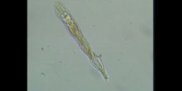 A ‘Zombie Worm’ Came Back to Life After 24,000 Years and Started Multiplying