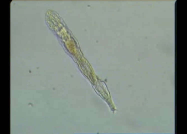 A ‘Zombie Worm’ Came Back to Life After 24,000 Years and Started Multiplying