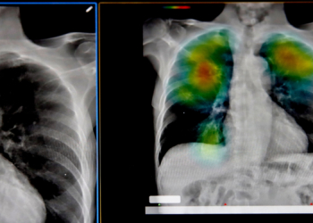 Doctors May Soon Be Able to Diagnose Illnesses Before You Ever Feel Sick