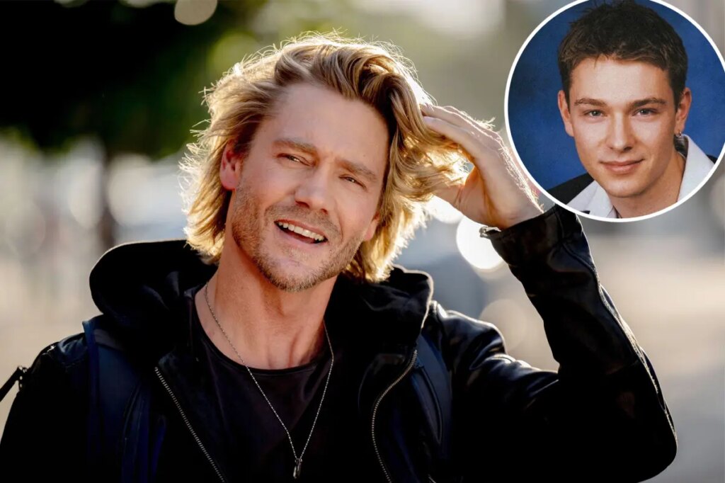 Chad Michael Murray fans stunned by ‘unrecognizable’ photo of actor before nose injury transformed his face