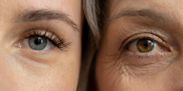 These tests claim to tell your ‘biological age.’ Why the science isn’t there yet.